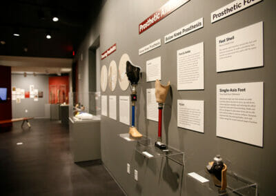 Prosthetic artifacts on display showing prosthetic anatomy including an above-knee prosthesis, below-knee prosthesis, and prosthetic foot.